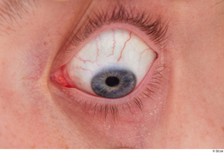 HD Eyes Brett eye eye texture eyelash iris pupil skin…